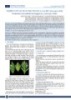 Nghiên cứu sản xuất trà túi lọc lá sa kê (Artocarpus altilis)